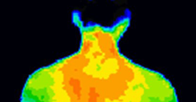 Thermography